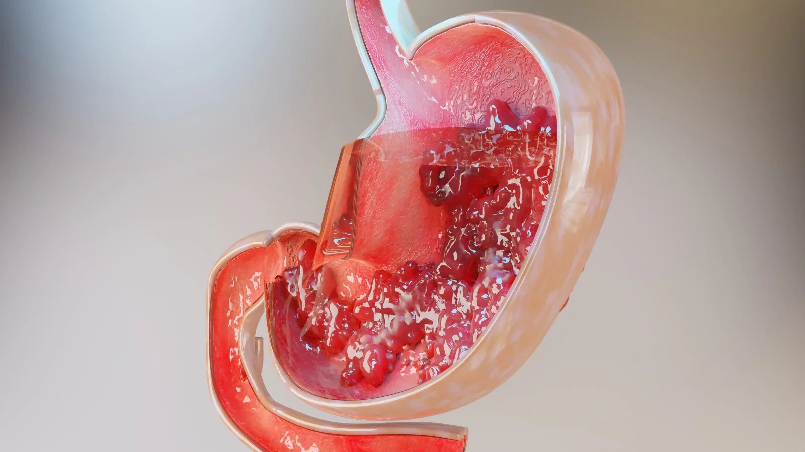 Why Should You Consider Trying Plant-Based Digestive Enzymes?